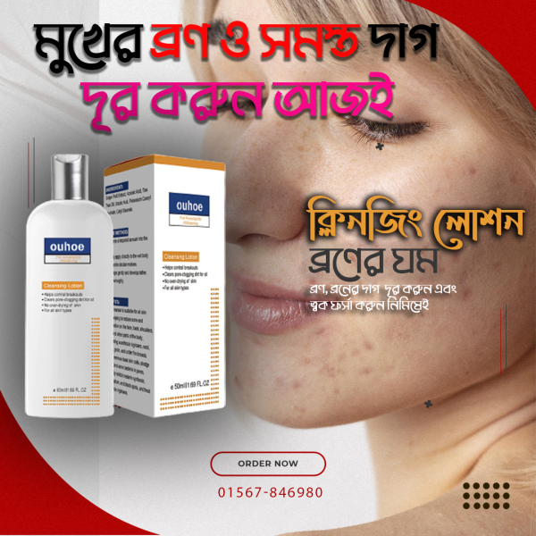 ক্লিনজিং লোশন ব্রণ এবং দাগ দূর করার লোশন